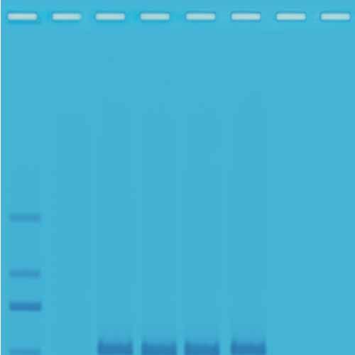 Kit d'expérimentation, empreinte génétique humaine de séquence Alu basée sur la PCR