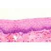 Épithélium stratifié plate, c.  (1)