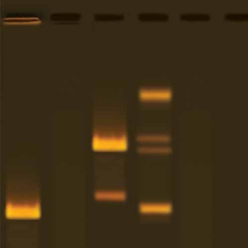 Kit d'expérimentation, analyse de la méthylation de l'ADN à l'aide d'enzymes de restriction
