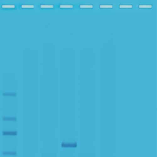 Kit d'expérimentation, Analyse de la qualité de l'eau III: Analyse PCR multiplexée de contaminants de l'eau