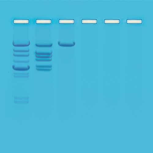 Kit d'expérimentation, clivage de l'ADN Lambda avec une Endonucléase EcoRI : Présentation des Enzymes de Restriction