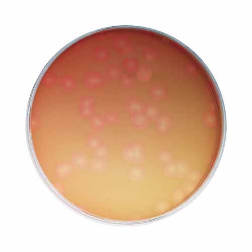 Kit d'expérimentation, découverte de la nature infectieuse des virus