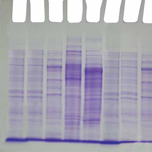 Kit d'expérimentation, identification des profils de protéines bactériennes