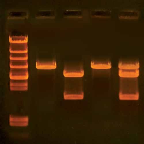Kit d'expérimentation, recherche du gène du cholestérol
