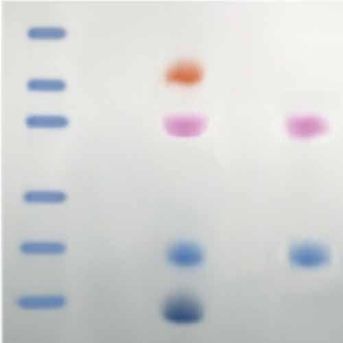 Kit d'expérimentation, SIDA Kit III: Simulation de la détection du VIH par électrophorèse de protéines