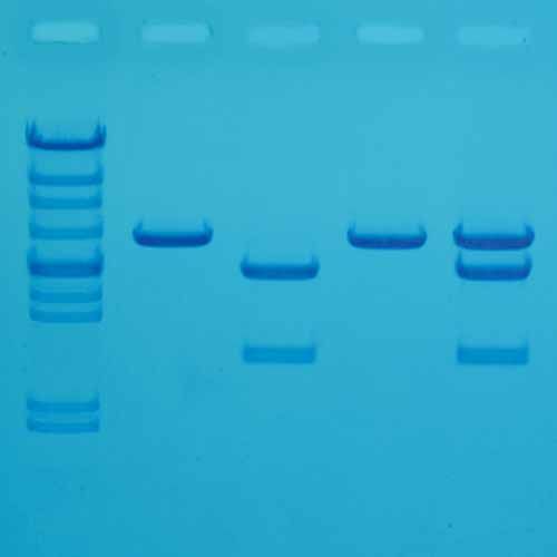 Kit Ready-to-Load™, diagnostic du cholestérol par tests génétiques