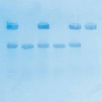 Kit Ready-to-Load™, recherche du gène responsable de la drépanocytose par la méthode de transfert Southern Blot