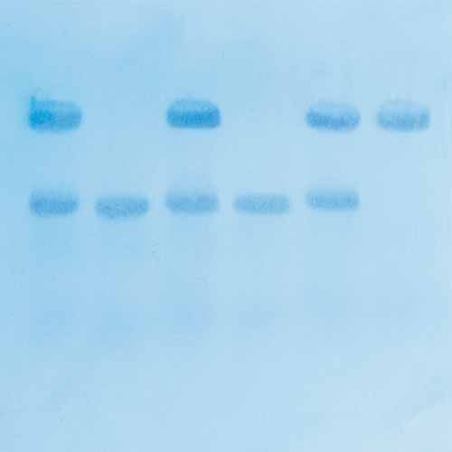Kit Ready-to-Load™, recherche du gène responsable de la drépanocytose par la méthode de transfert Southern Blot