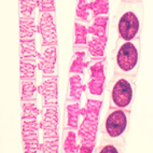 Lame microscopique préparée, algues, conjugaison de Spirogyra, s.e.