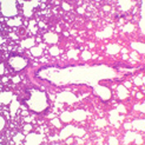 Lame microscopique préparée, Section de poumon