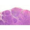 Lame microscopique préparée, système et organes, Ganglion lymphatique, c.