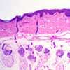 Lame microscopique préparée, système nerveux et organe des sens, Peau humaine, glandes sudoripares,  c.    (1),(3)