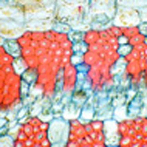 Lame microscopique préparée, tissue angiosperme, Tige avec sclérenchyme, c.t.  (2)