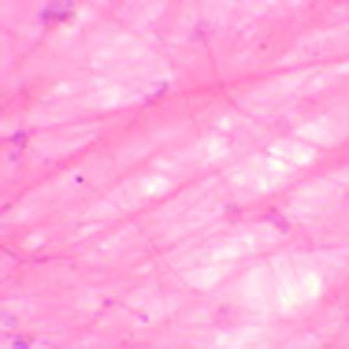 Lame microscopique préparée, tissue basique, Tissu conjonctif lâche, s.e.  (1)