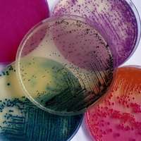 Lames gélosées pour microbiologie