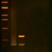PCR par transcription inverse (RT-PCR): biologie moléculaire de la réplication du VIH